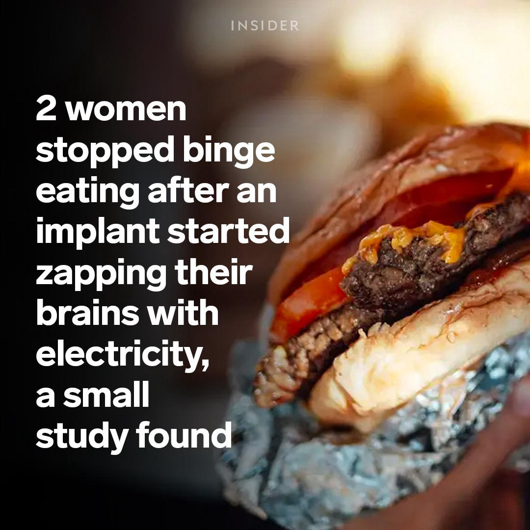 Science Insider - A brain implant reduced two patients' binge eating for at least six months